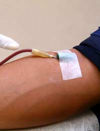 Blood Doping; Blood Packing; Epo; Blood